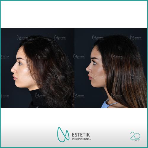 Before after photos of our patients 11